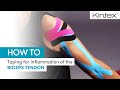 HOW TO | Kinesiology taping for inflammation of the biceps tendon