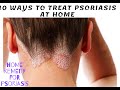 10 Ways to Treat Psoriasis at Home | home remedy for psoriasis