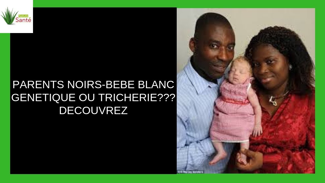 Des Parents Noirs En Angleterre Donnent Naissance Au Bebe Blanc Yeux Bleus Voici La Reaction Du Pere Youtube
