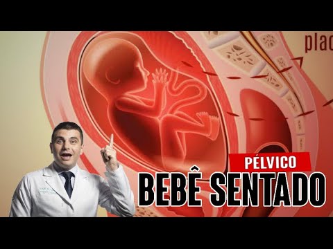 Vídeo: Meu bebê pode estar sentado na minha bexiga?