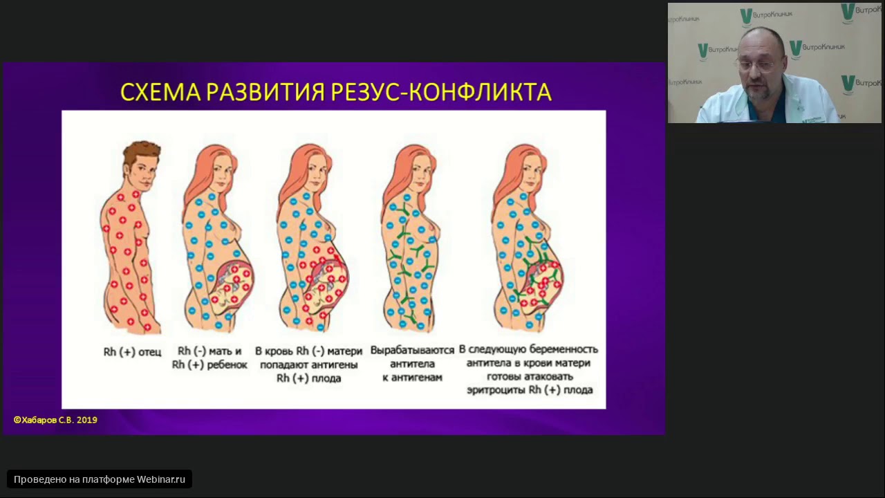 Резус конфликт у резус положительной матери