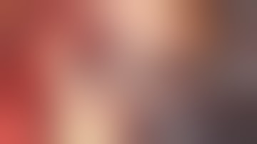 Aortic Valve Reconstruction for Endocarditis using Tissue Engineered Bovine Pericardium