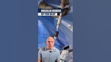 Drilling Away Hip Pain: Core Decompression #shorts