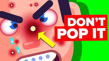 Why You Should NEVER Pop a Pimple