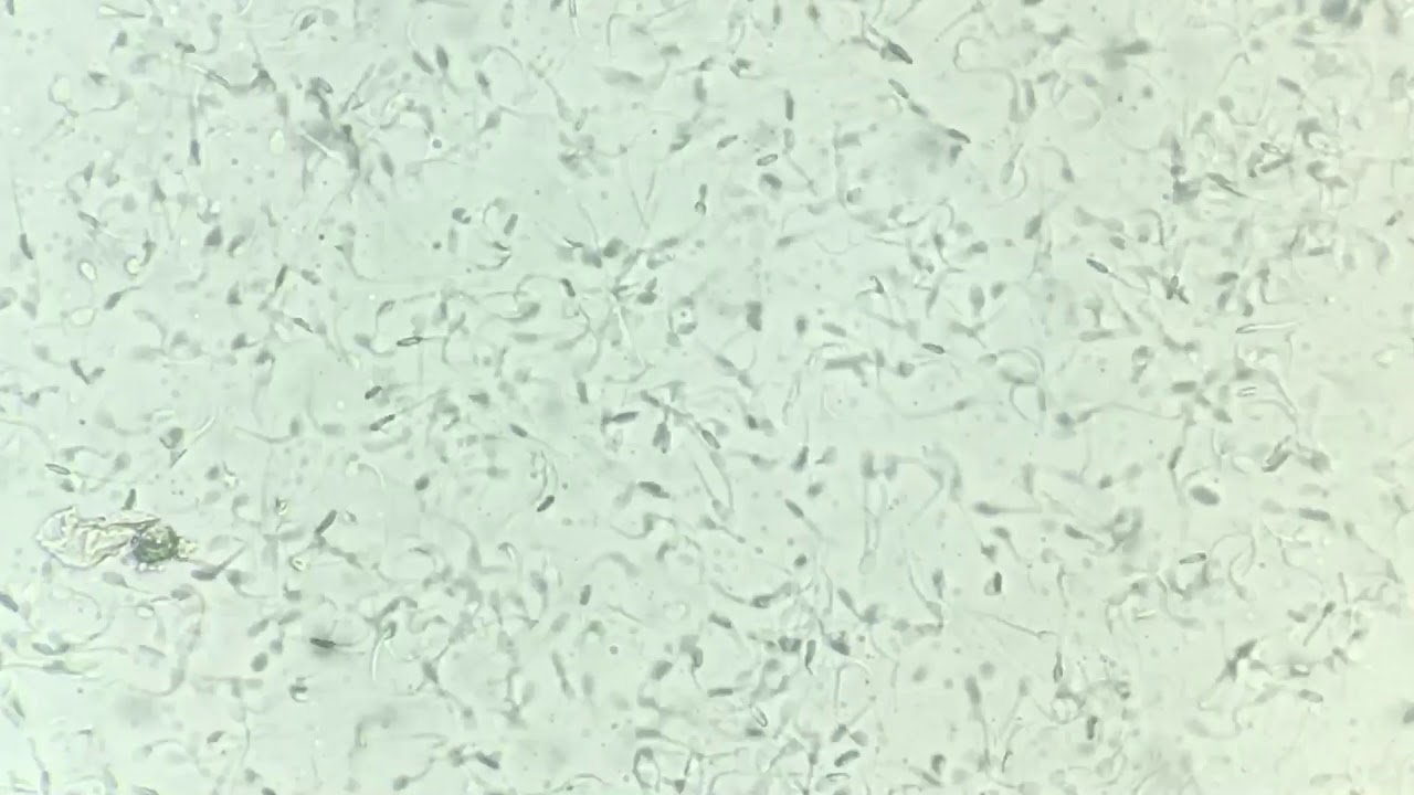 Dog spermatozoa microscopy YouTube