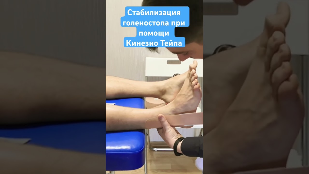 Кинезио тейп для стабилизации голеностопа