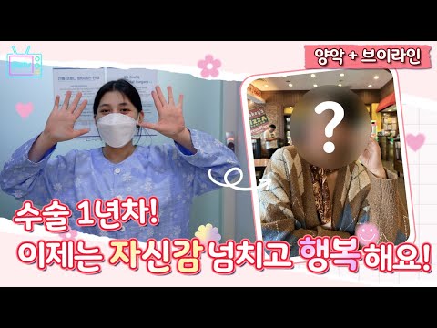 ขากรรไกรคู่ + วีไลน์ ครบ 1 ปี มั่นใจและมีความสุขขึ้น