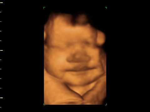 baby Yezaneiah Christine Jimenez