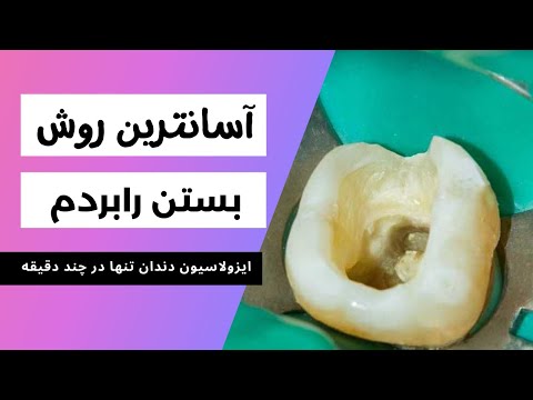 روش سریع و آسان بستن رابردم برای بیماران دندانپزشکی