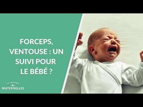 Vidéo: Qu'est-ce qui se passe quand vous avez une naissance Ventouse