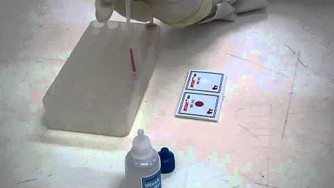 InstantChek HIV 1+2 NEGATIVE assay procedure (60 SECONDS Test)