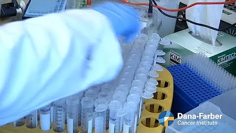 Neuroendocrine Tumors (NET) | Dana-Farber Cancer Institute