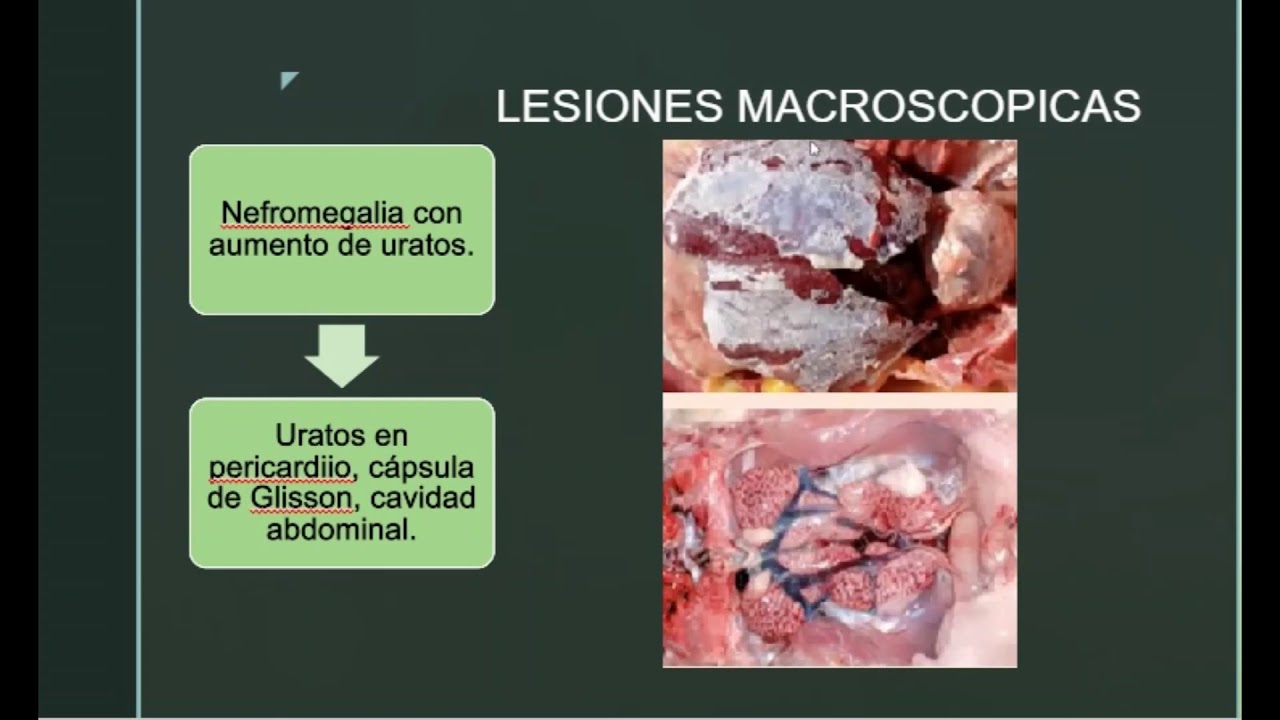 Nefritis aviar 