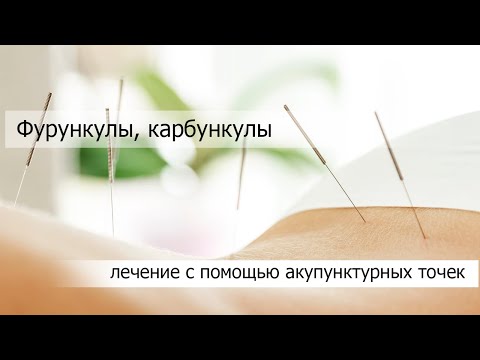 Фурункулы, карбункулы