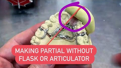 MAKING A PARTIAL DENTURE WITHOUT FLASK OR ARTICULATOR USING REPAIR ACRYLIC. صناعة تعويض جزئي #WAXBAE