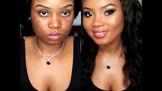 HOW TO/FOUNDATION ROUTINE FOR ACNE SCARS/HIGHLIGHT & CONTOUR by Gggg 582 views 8 years ago 6 minutes, 58 seconds