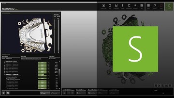 Our scan software, Zirkonzahn.Scan! | Zirkonzahn.Software