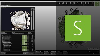 Our scan software, Zirkonzahn.Scan! | Zirkonzahn.Software