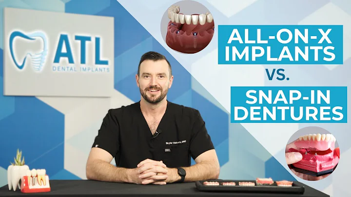 Don’t Choose the Wrong Option: All-on-X vs. Snap-In Dentures Explained!