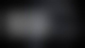 Getting Started in Robotic Colorectal Surgery | The Learning Curve