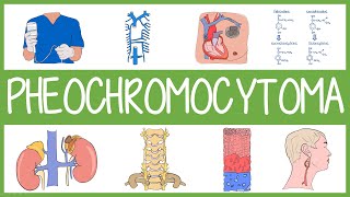 Pheochromocytoma in 3 Minutes