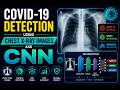 Covid 19 Detection from Chest X Ray Images using CNN