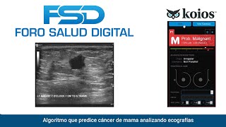 Predicciu00f3n de lesiu00f3n maligna de la mama analizando ecografu00eda mamaria (Koios DS For Breast)