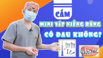 Cắm Mini Vít Niềng Răng Có Đau Không | Bác sĩ Trung Long Biên