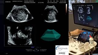 Otra capacitación de manejo para el usuario con el HS40. Énfasis en 3D/4D.