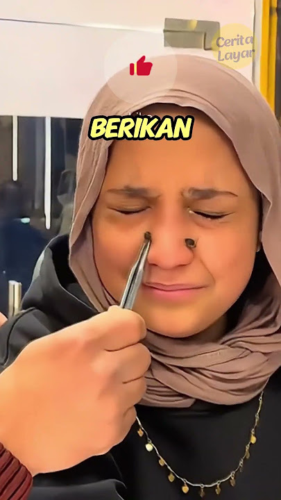 Akibat Di Sengat Lebah!