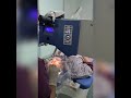 Laser Eye Surgery in Antalya Turkey