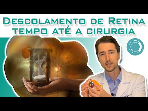 Vídeo: O descolamento de retina pode ser reparado?