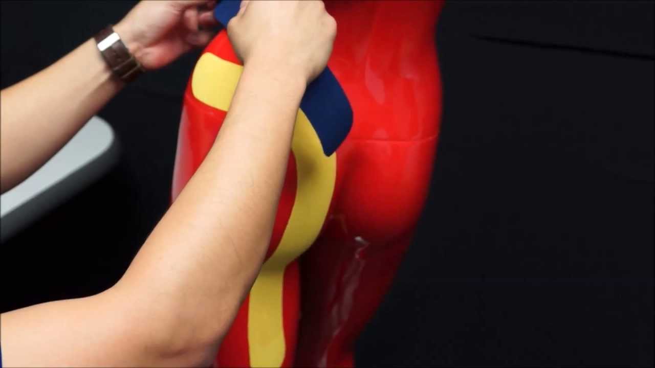 Muscleaidtape Sciatica Youtube