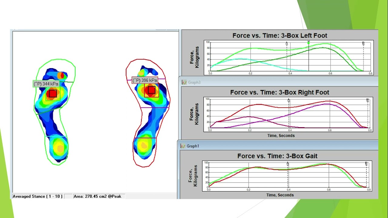 Versatile Foot Pressure Assessments with MobileMat 