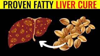 9 Home Remedies For Fatty Liver (Proven)