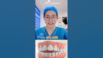 Răng Bị Chạy Lại Sau Khi Niềng – Vì Sao & Cách Khắc Phục | BS. Linh Giải Đáp