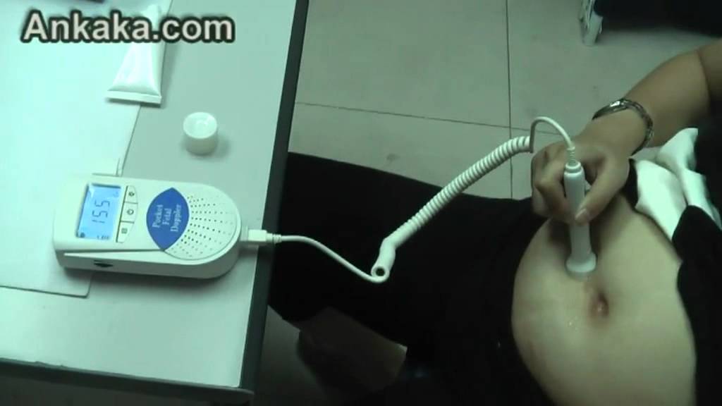 pregnancy heart monitor doppler