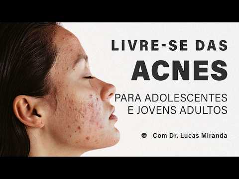 Espinhas ou Acne na adolescência, como cuidar?