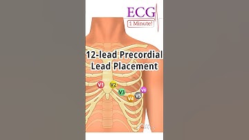 1 Minute ECG: 12-Lead Precordial Lead Placement