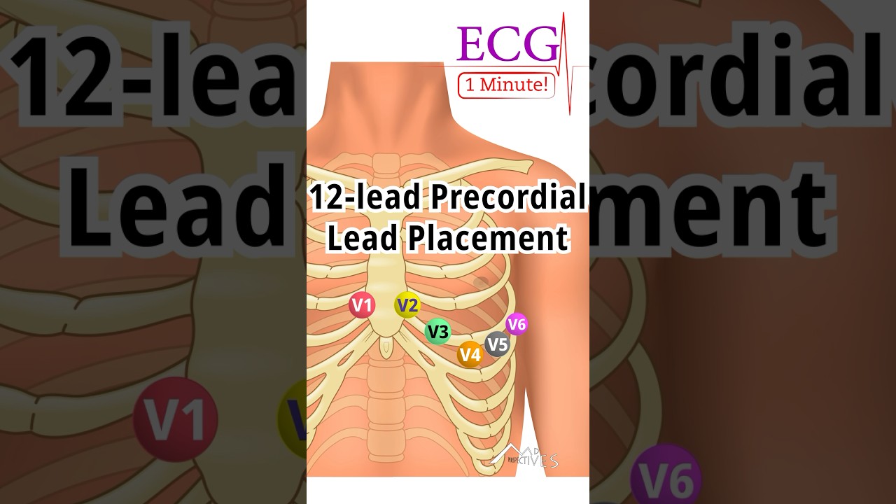 1 Minute ECG: 12-Lead Precordial Lead Placement