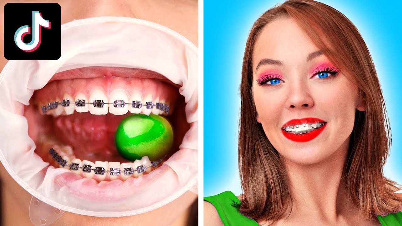 ⁣تقويم الأسنان يدمر حياتي – مشكلات غريبة تعاني منها الفتيات | مواقف مألوفة ومحرجة