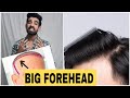 Big Forehead Tips Receding Hairline Shorts Hairloss 