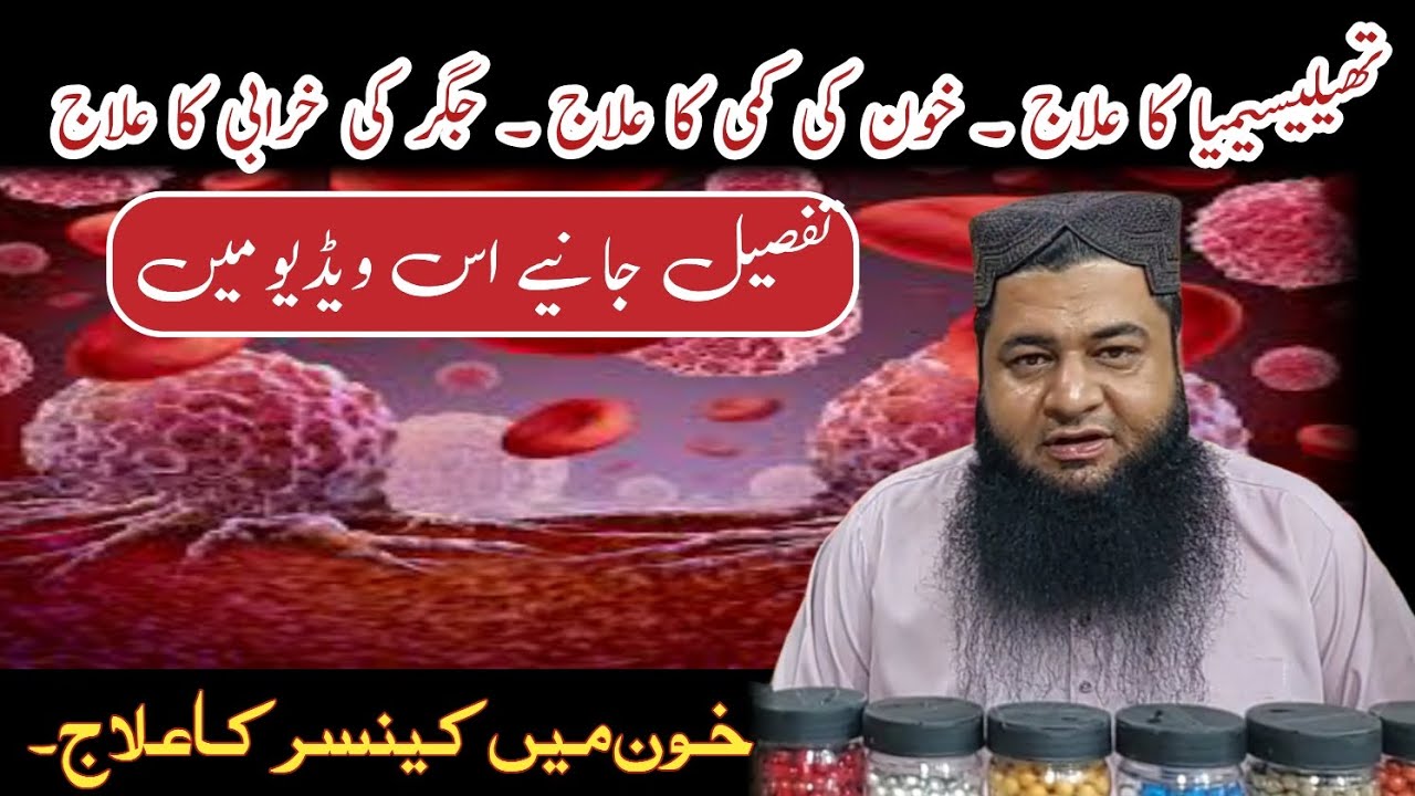 Blood cancer information in Urdu| Leukemia ka ilaj| Thalassemia Kya Hai or iska ilaaj 