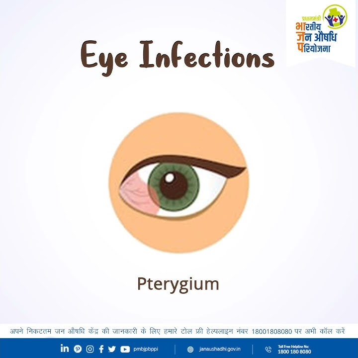 Types of Eye Infections