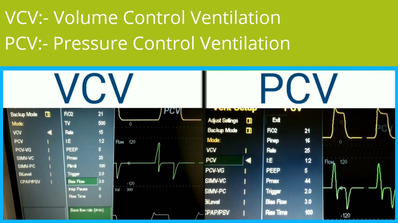 VCV (Volume-Controlled Ventilation). Volume Control Ventilation. (PCV - Pressure Control Ventilation. Программа Volume Control,. Volume support