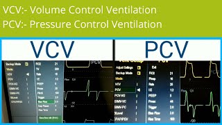 Ventilator settings | VCV vs PCV | Volume Control Ventilation VS Pressure Control Ventilation