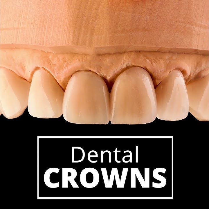 Dental Crown