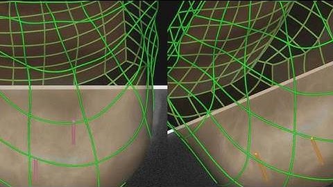 Computer modelling and cancer outcomes