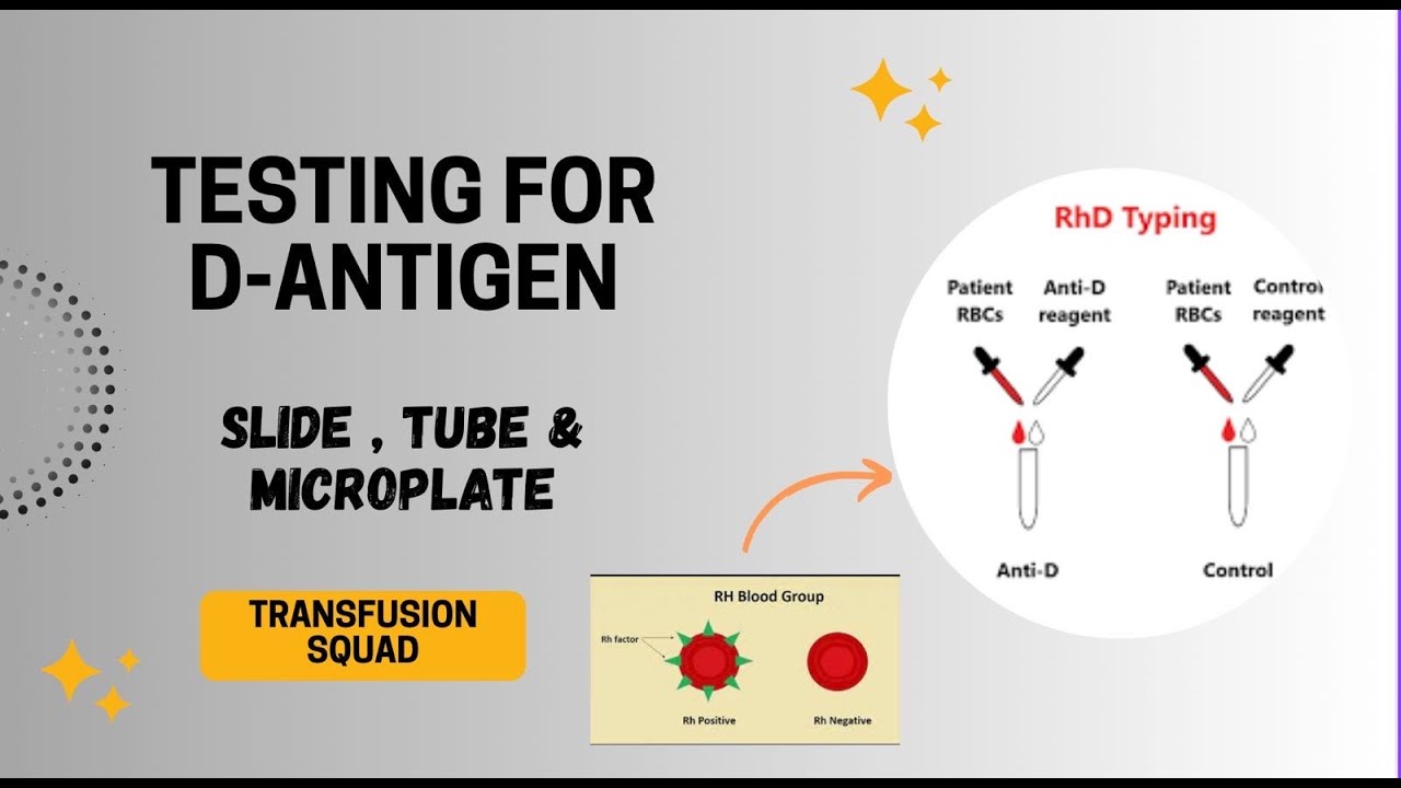 Antidsd Lab ANTI D TESTING - YouTube