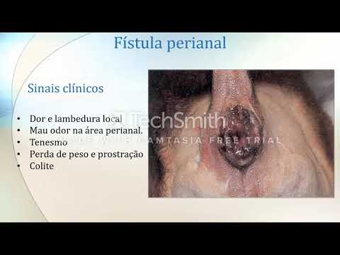 Vídeo: Câncer De Glândula Anal Em Cães